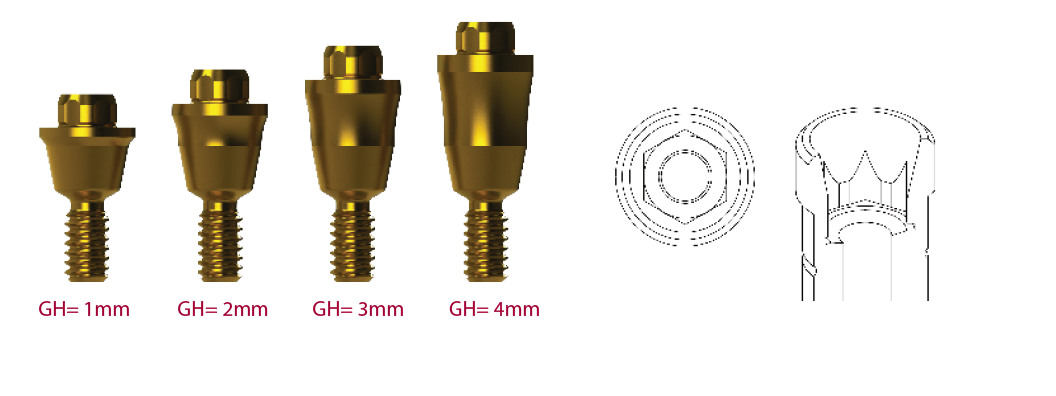 DAS Multi-Unit abutment rovný, gingivální výška 1 mm